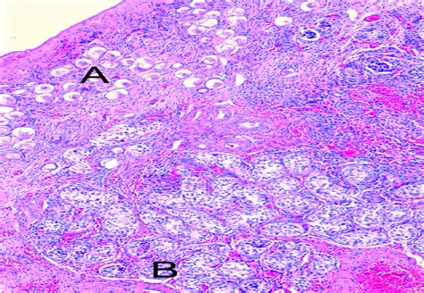 Pregnancy in true hermaphrodites and all male offspring to date